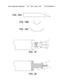 INTRAOCULAR DELIVERY DEVICES AND METHODS THEREFOR diagram and image