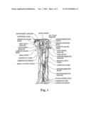 SYSTEM AND METHOD OF PRE-AORTIC GANGLION ABLATION diagram and image