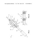 DEVICES, SYSTEMS, AND METHODS FOR TREATING CARDIAC ARRHYTHMIAS diagram and image