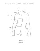 SKELETAL MANIPULATION METHOD diagram and image