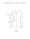 SKELETAL MANIPULATION METHOD diagram and image