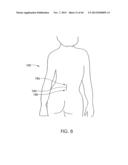 SKELETAL MANIPULATION METHOD diagram and image