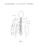 SKELETAL MANIPULATION METHOD diagram and image