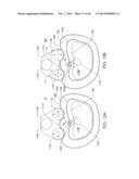 SKELETAL MANIPULATION METHOD diagram and image