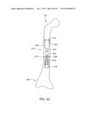 SKELETAL MANIPULATION METHOD diagram and image