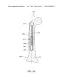 SKELETAL MANIPULATION METHOD diagram and image