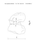 CUSTOMIZED PATIENT-SPECIFIC ORTHOPAEDIC PIN GUIDES diagram and image