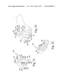 CUSTOMIZED PATIENT-SPECIFIC ORTHOPAEDIC PIN GUIDES diagram and image