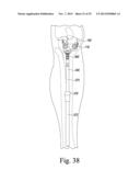 CUSTOMIZED PATIENT-SPECIFIC ORTHOPAEDIC PIN GUIDES diagram and image