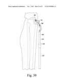 CUSTOMIZED PATIENT-SPECIFIC ORTHOPAEDIC PIN GUIDES diagram and image