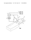 ROBOTIC ARTHROPLASTY SYSTEM diagram and image