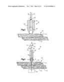 ROBOTIC ARTHROPLASTY SYSTEM diagram and image