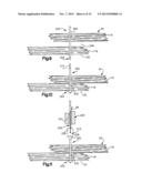 ROBOTIC ARTHROPLASTY SYSTEM diagram and image