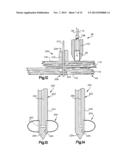 ROBOTIC ARTHROPLASTY SYSTEM diagram and image