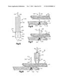 ROBOTIC ARTHROPLASTY SYSTEM diagram and image