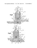 ROBOTIC ARTHROPLASTY SYSTEM diagram and image