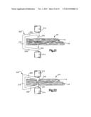 ROBOTIC ARTHROPLASTY SYSTEM diagram and image