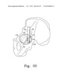 RECIPROCATING RASPS FOR USE IN AN ORTHOPAEDIC SURGICAL PROCEDURE diagram and image