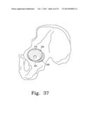 RECIPROCATING RASPS FOR USE IN AN ORTHOPAEDIC SURGICAL PROCEDURE diagram and image