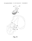 RECIPROCATING RASPS FOR USE IN AN ORTHOPAEDIC SURGICAL PROCEDURE diagram and image