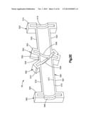 Surgical Guide with Cut Resistant Inserts diagram and image