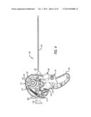 ANCHOR DELIVERY SYSTEM diagram and image