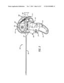 ANCHOR DELIVERY SYSTEM diagram and image