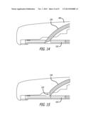 ANCHOR DELIVERY SYSTEM diagram and image