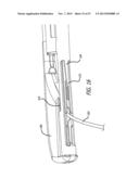 ANCHOR DELIVERY SYSTEM diagram and image