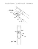 ANCHOR DELIVERY SYSTEM diagram and image