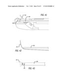 ANCHOR DELIVERY SYSTEM diagram and image