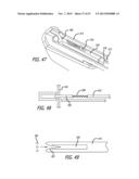 ANCHOR DELIVERY SYSTEM diagram and image