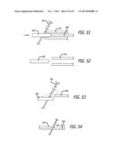 ANCHOR DELIVERY SYSTEM diagram and image