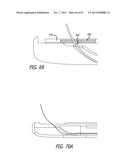 ANCHOR DELIVERY SYSTEM diagram and image