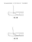 ANCHOR DELIVERY SYSTEM diagram and image