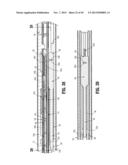 Endoscopic Surgical Clip Applier with Clip Retention diagram and image