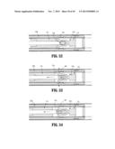 Endoscopic Surgical Clip Applier with Clip Retention diagram and image