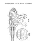 Endoscopic Surgical Clip Applier with Clip Retention diagram and image