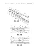 Endoscopic Surgical Clip Applier with Clip Retention diagram and image