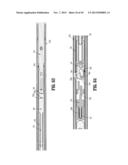 Endoscopic Surgical Clip Applier with Clip Retention diagram and image