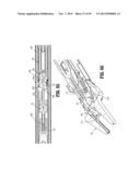 Endoscopic Surgical Clip Applier with Clip Retention diagram and image