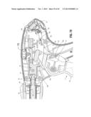 Endoscopic Surgical Clip Applier with Clip Retention diagram and image