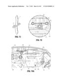 Endoscopic Surgical Clip Applier with Clip Retention diagram and image