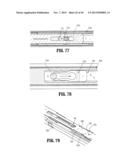 Endoscopic Surgical Clip Applier with Clip Retention diagram and image