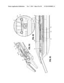 Endoscopic Surgical Clip Applier with Clip Retention diagram and image