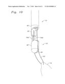 SINGLE CATHETER HEART REPAIR DEVICE AND METHOD FOR USE diagram and image