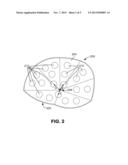 SELF ADHERING IMPLANTABLE MESH PROSTHESIS WITH REDUCED INSERTION PROFILE diagram and image