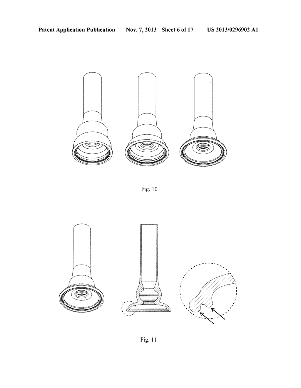 VACUUM ANCHORING CATHETER - diagram, schematic, and image 07