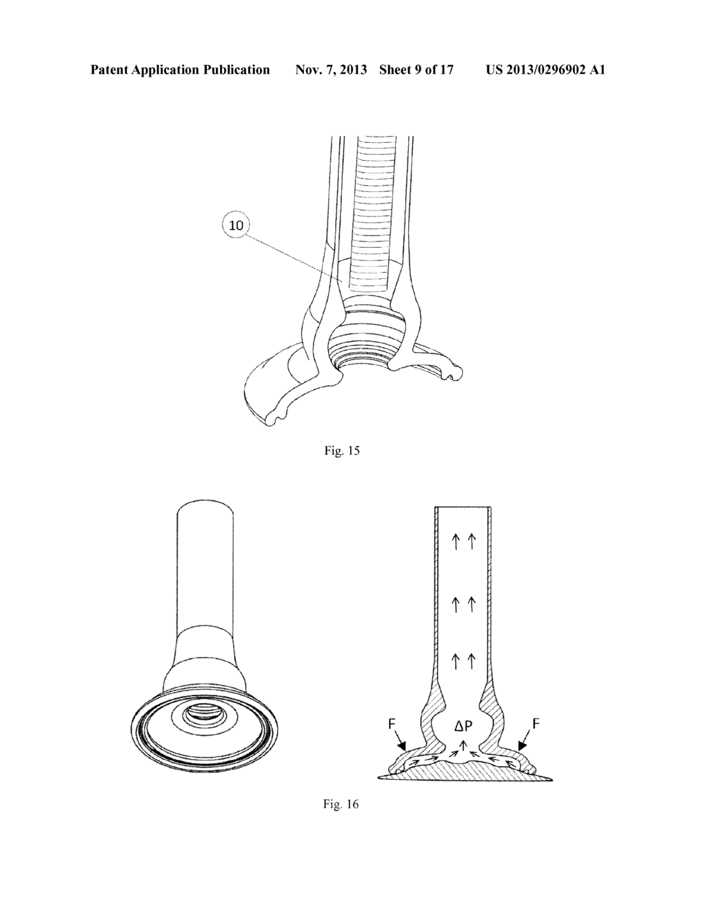 VACUUM ANCHORING CATHETER - diagram, schematic, and image 10