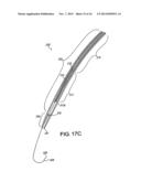 TRANSSEPTAL GUIDEWIRE diagram and image